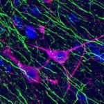 Axônios de neurônios corticais estimulados (em verde) projetam para a área escura e ativam neurônios (em rosa); os demais permanecem inalterados (azul) Imagem-Alexandre Magno / Faculdade de Medicina da UFMG
