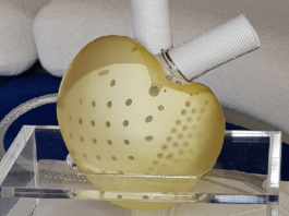 Coração artificial é esperança para milhares de pessoas que precisam de um transplante. Fotos - Carmat-divulgação
